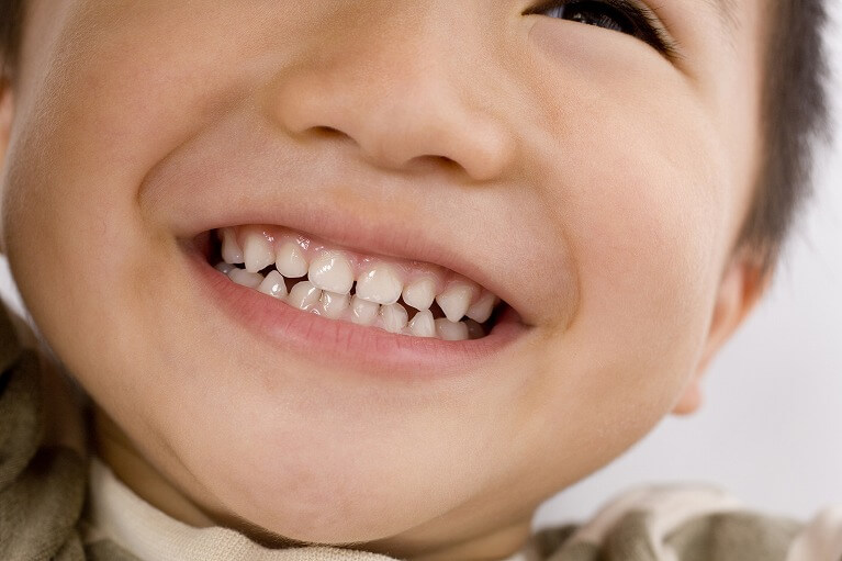 お子さんの虫歯を放置するリスク