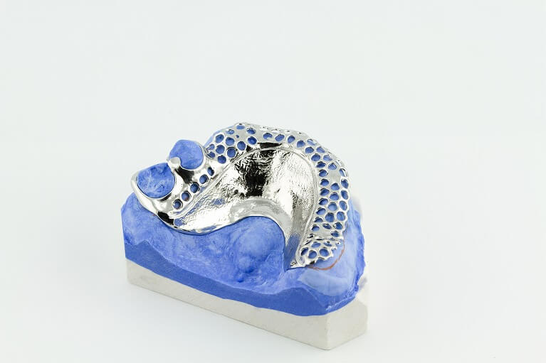 金属床義歯の特徴
